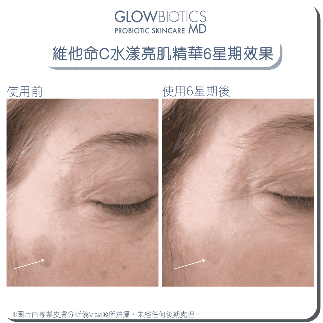 益菌維他命C水漾亮肌精華 - Derm - Mart