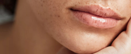 嘴唇又乾又薄點算好?