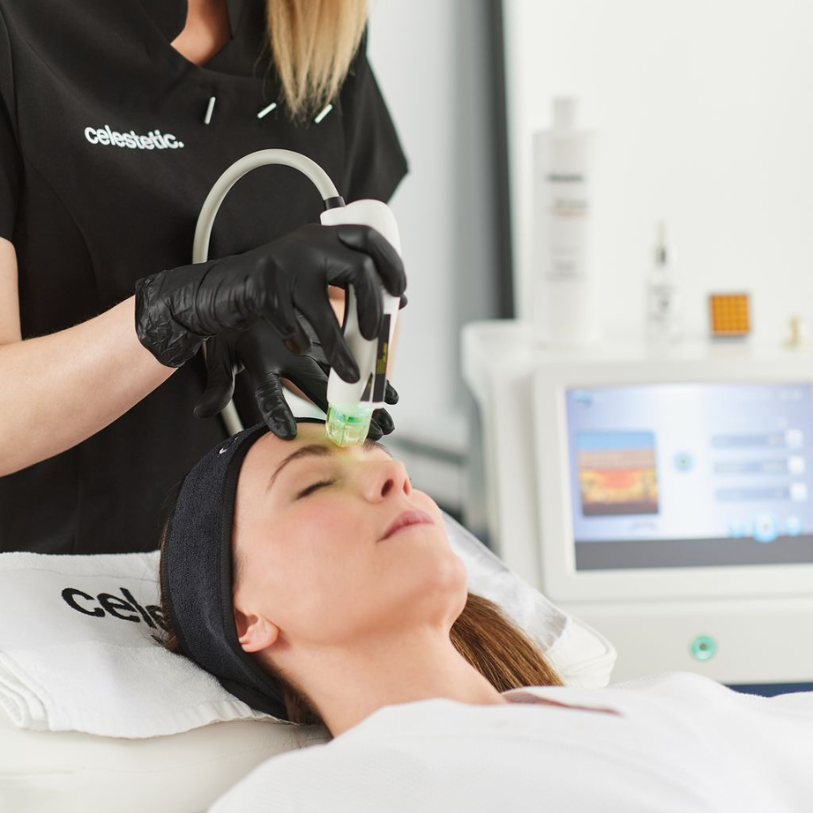 Upskin II 全效膠原自生槍