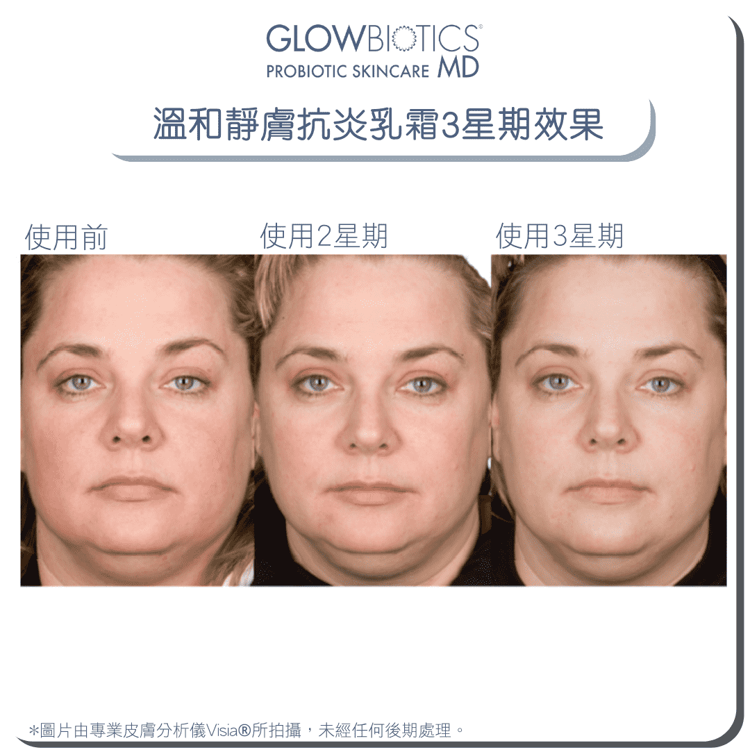 溫和靜膚抗炎乳霜 - Derm - Mart